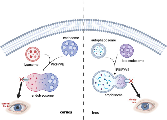 Figure for Genetic Variants in PIKFYVE: A Review of Ocular Phenotypes.