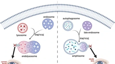 Genetic Variants in PIKFYVE: A Review of Ocular Phenotypes. featured image